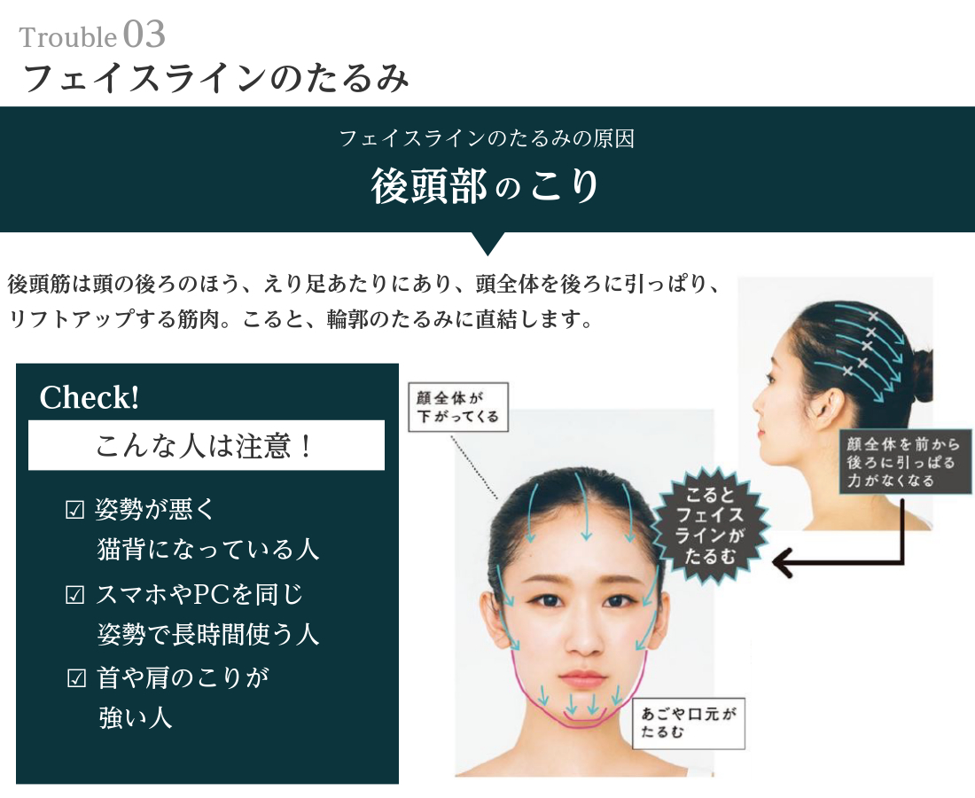 写真：Trouble03 フェイスラインのたるみ フェイスラインのたるみの原因　後頭部のこり 後頭筋は頭の後ろのほう、あり足あたりにあり、頭全体を後ろにひっぱり、リフトアップする筋肉。 こると、輪郭のたるみに直結します。 Check！こんの人は注意！ ・姿勢が悪く猫背になっている人 ・スマホやPCを同じ姿勢で長時間使う人 ・首や肩こりが強い人