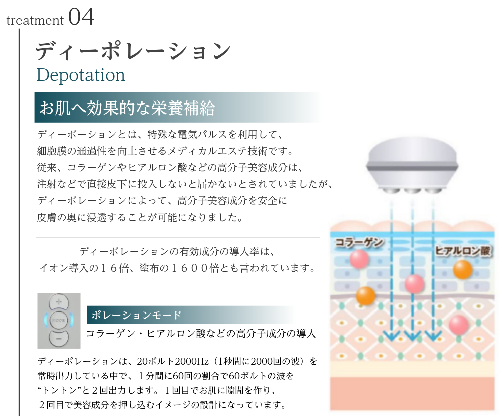 説明図：treatment04 ディーポレーション お肌へ効果的な栄養補給 特殊な電気パルスを利用して、細胞膜の透過性を向上させるメディカルエスト技術です。 従来、コラーゲンやヒアルロン酸などの高分子美容成分は、注射などで直接皮下に投入しないと届かないとされていましたが、高分子美容成分を安全に皮膚の奥に浸透することが可能です。 ■期待できる効果 ・お手持ちの美容液を肌深くにお届け