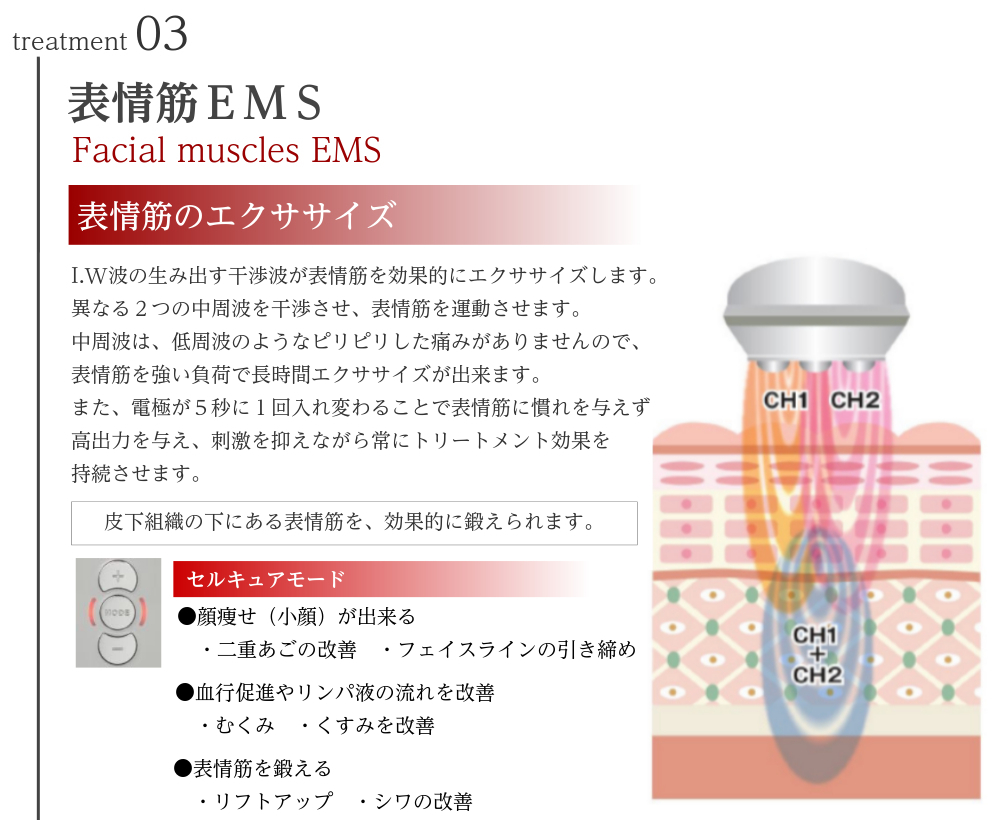 説明図：treatment03 表情筋EMS I.W波の生み出す干渉波が表情筋を効果的にエクササイズします。 異なる2つの中周波を干渉させ、表情筋を運動させます。 中周波は、低周波のようなピリピリした痛みがありませんので、表情筋を強い負荷で長時間エクササイズが出来ます。 ■期待できる効果 ・シワの改善、リフトアップ ・むくみ、くすみを改善 ・フェイスラインの引き締め