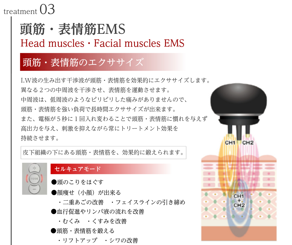 説明図：treatment03 表情筋EMS I.W波の生み出す干渉波が表情筋を効果的にエクササイズします。 異なる2つの中周波を干渉させ、表情筋を運動させます。 中周波は、低周波のようなピリピリした痛みがありませんので、表情筋を強い負荷で長時間エクササイズが出来ます。 ■期待できる効果 ・シワの改善、リフトアップ ・むくみ、くすみを改善 ・フェイスラインの引き締め